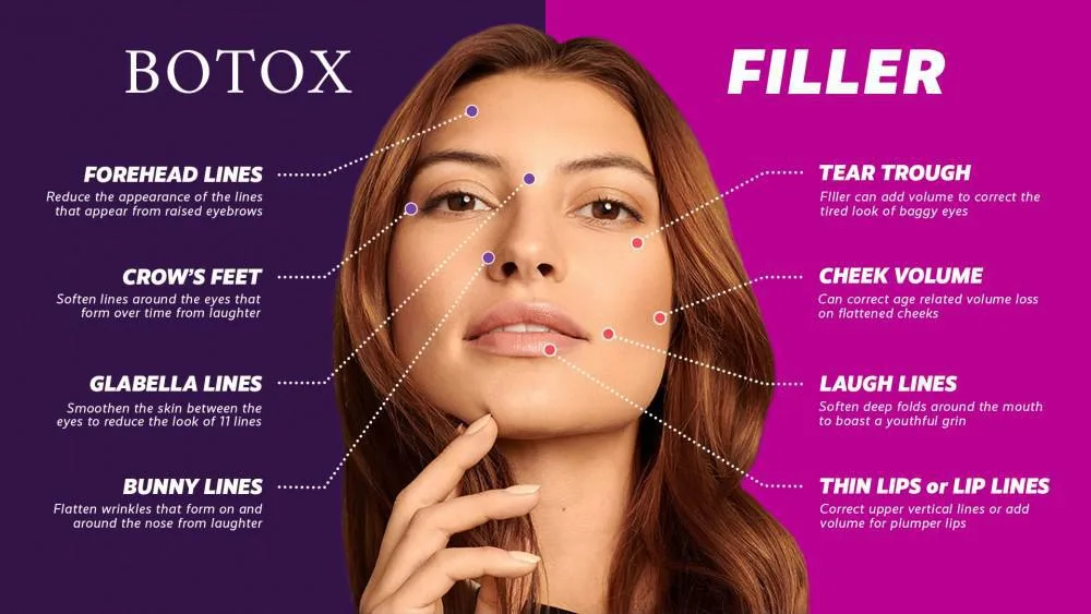 Botox and Filler, What Fits For You