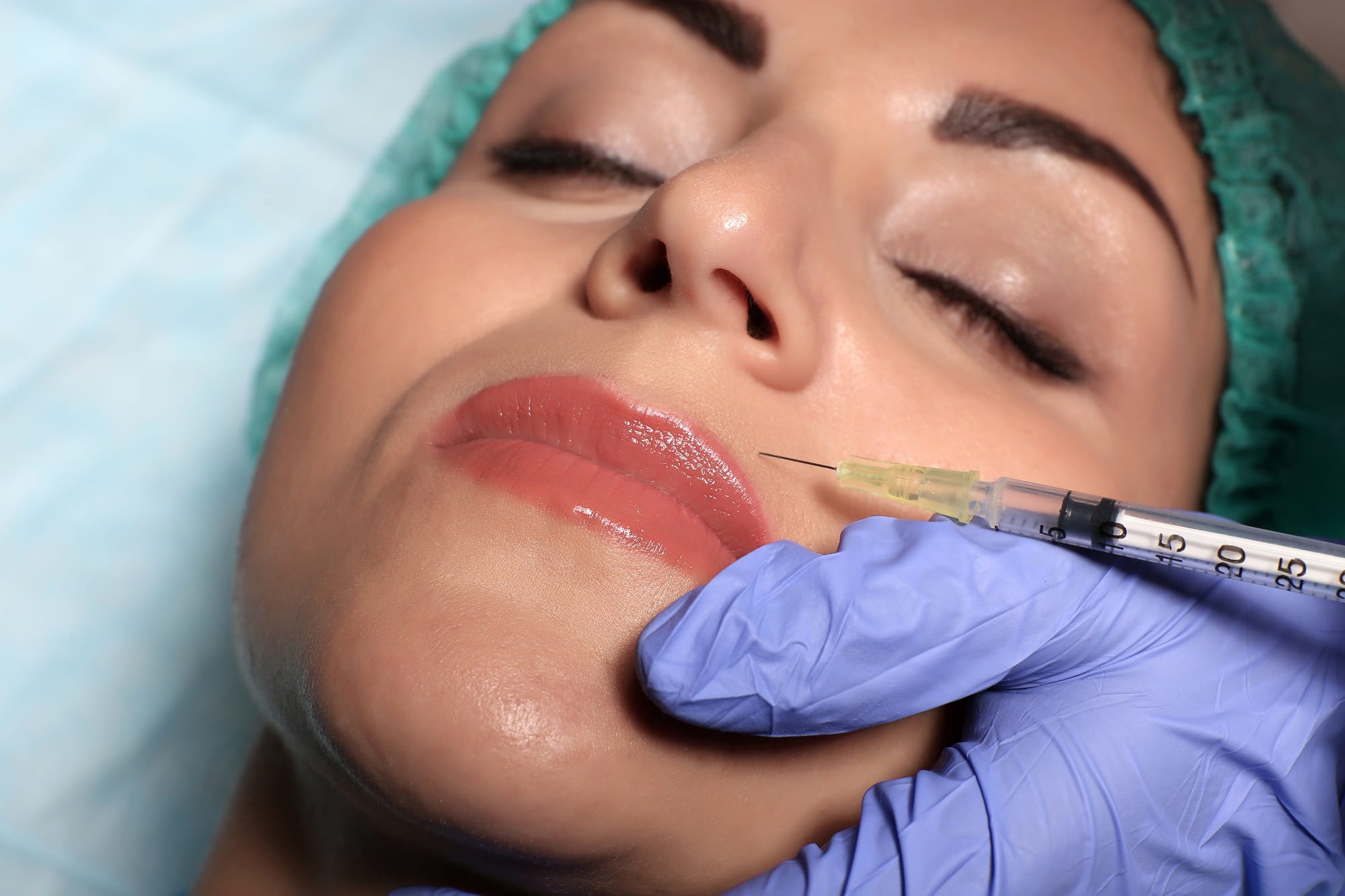 Facial Fillers In Nags Head Nc Lip Filler Dermal Fillers