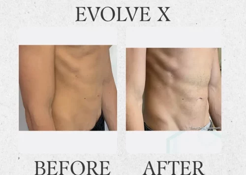 Outer Banks Dermatology before & after