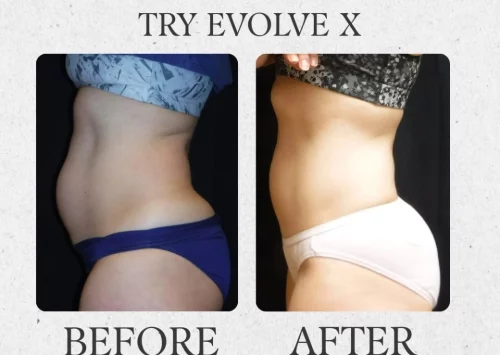 Outer Banks Dermatology before & after