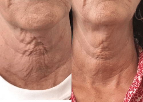 Gallery Images | Outer Banks Dermatology | Nags Head, NC